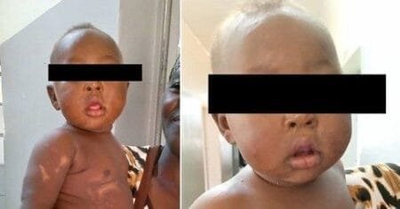 The newborn thankfully survived and was doing well at a six-month check up (Picture: Dove Medical Press Limited)
