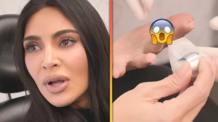 Kim Kardashian sustained a gruesome finger injury that apparently hurt more than giving birth. Hulu