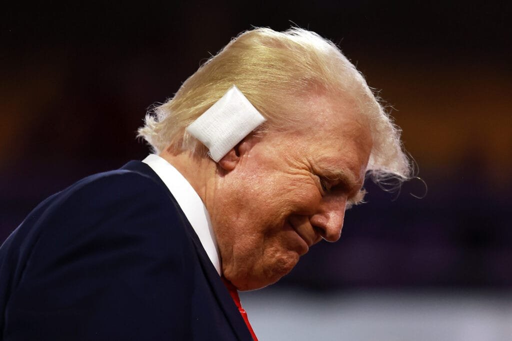 Republican presidential candidate and former President Donald Trump on Monday attends the first day of the Republican National Convention at the Fiserv Forum in Milwaukee, Wisconsin. Trump's former White House physician, Representative Ronny Jackson, provided an update on the former president's right ear that was grazed by a bullet during Saturday's assassination attempt. Less JOE RAEDLE/GETTY IMAGES