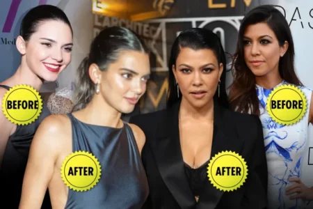 Dr Harper of Juvly Aesthetics speculated facial work on Kourtney Kardashian Barker and Kendall Jenner
